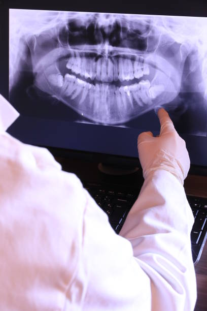Best Walk-In Emergency Dentist in Radisson, NY